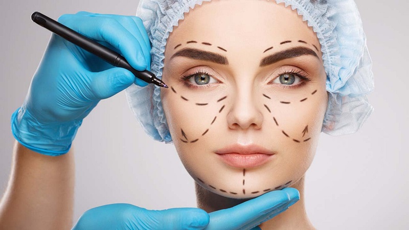  What are the perks of Plastic Surgery?